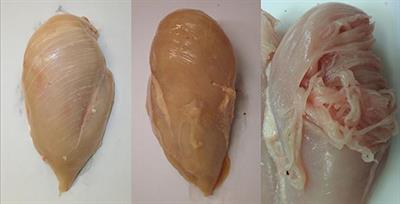 Characterising the Influence of Genetics on Breast Muscle Myopathies in Broiler Chickens